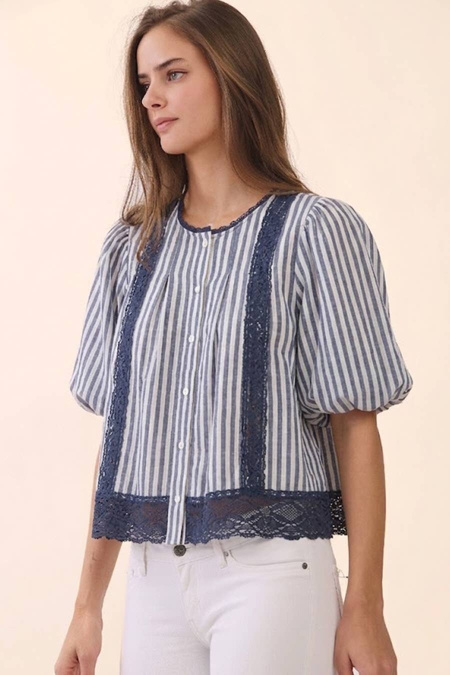 Lace and Stripe Button Up Top